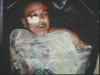 iraq torture photo 3